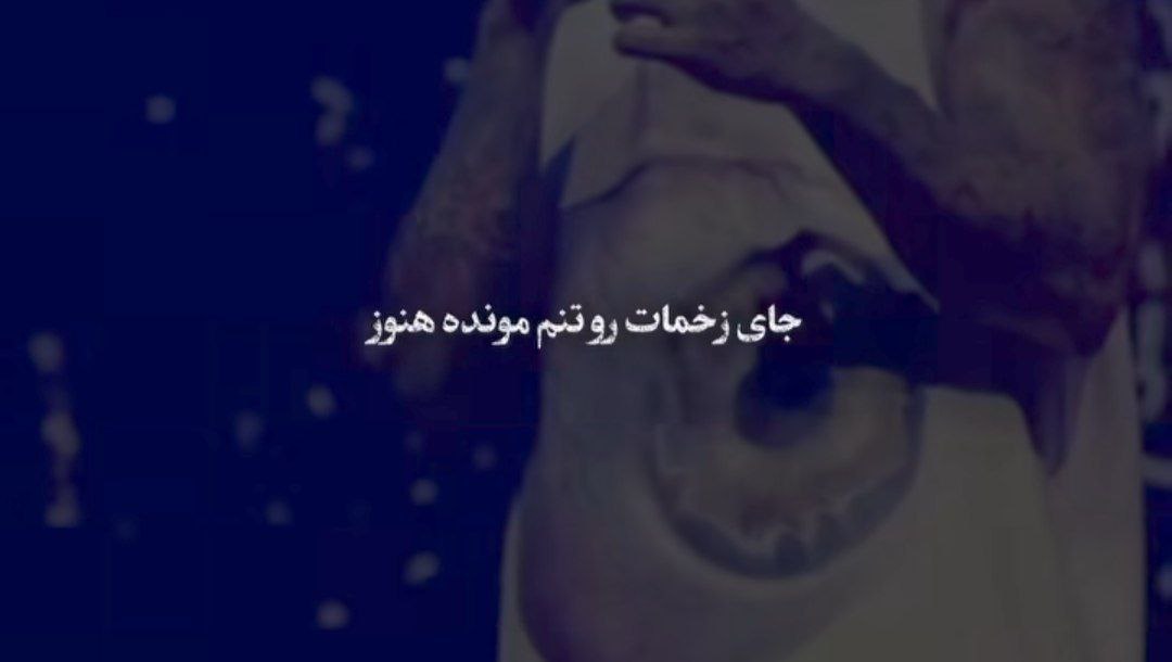 جای زخمات رو تنم مونده هنوز تتلو هوش مصنوعی